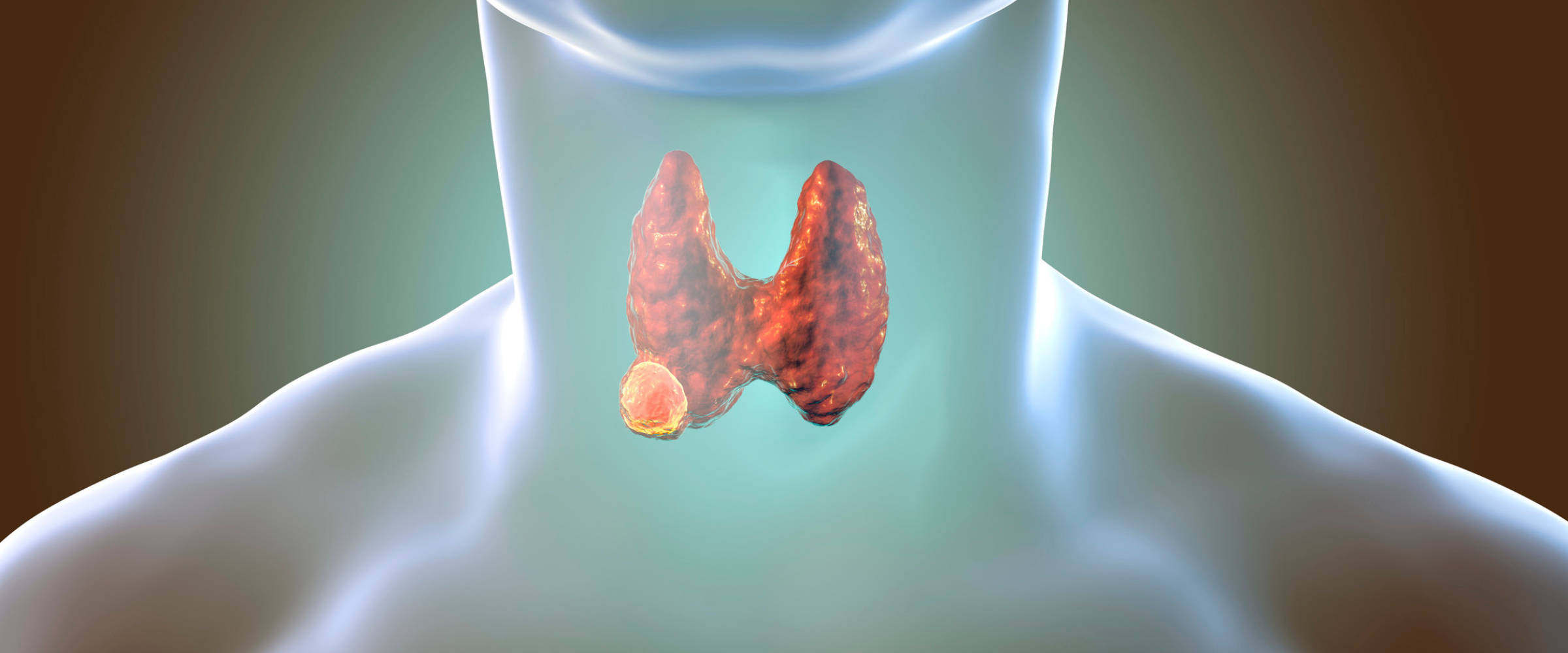 What are Early Warning Signs of Thyroid Problems